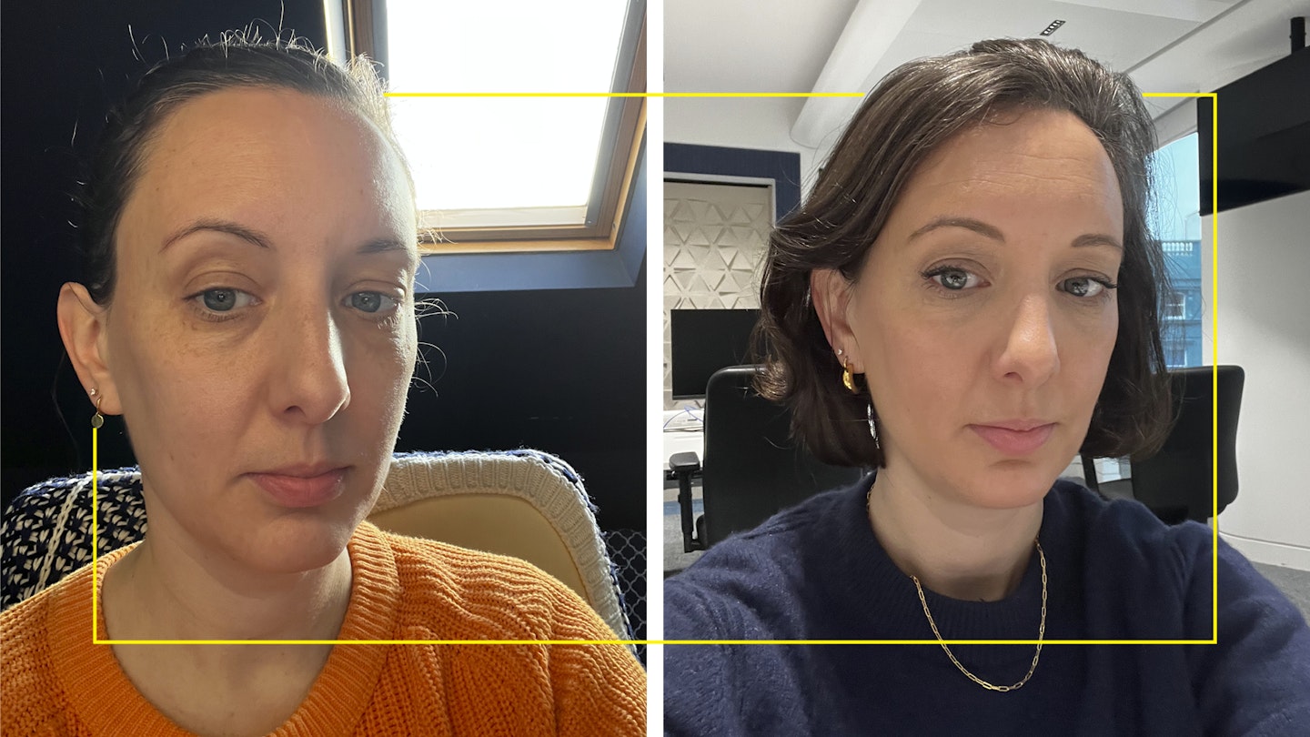 face taping for wrinkles